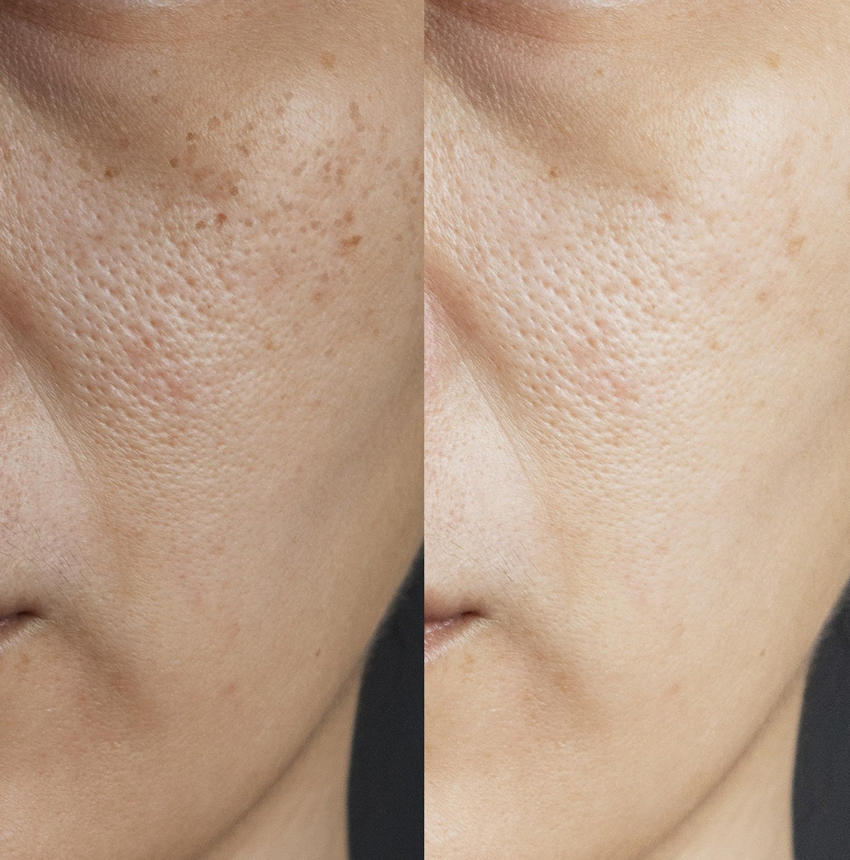 dehydrated skin