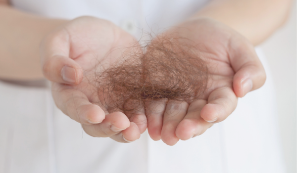 summer hair loss