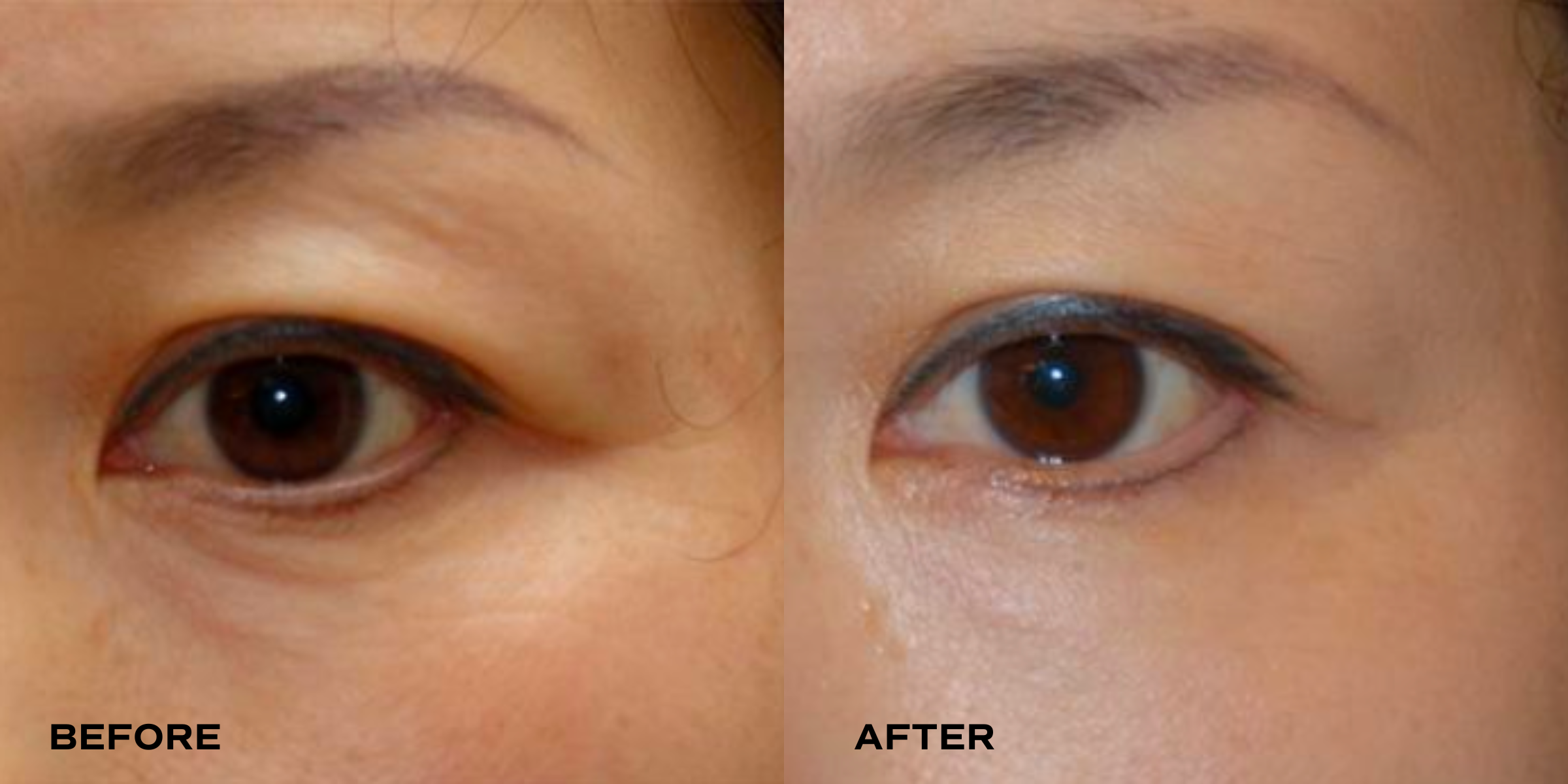 All-in-One Eye Cream Sample (5g)