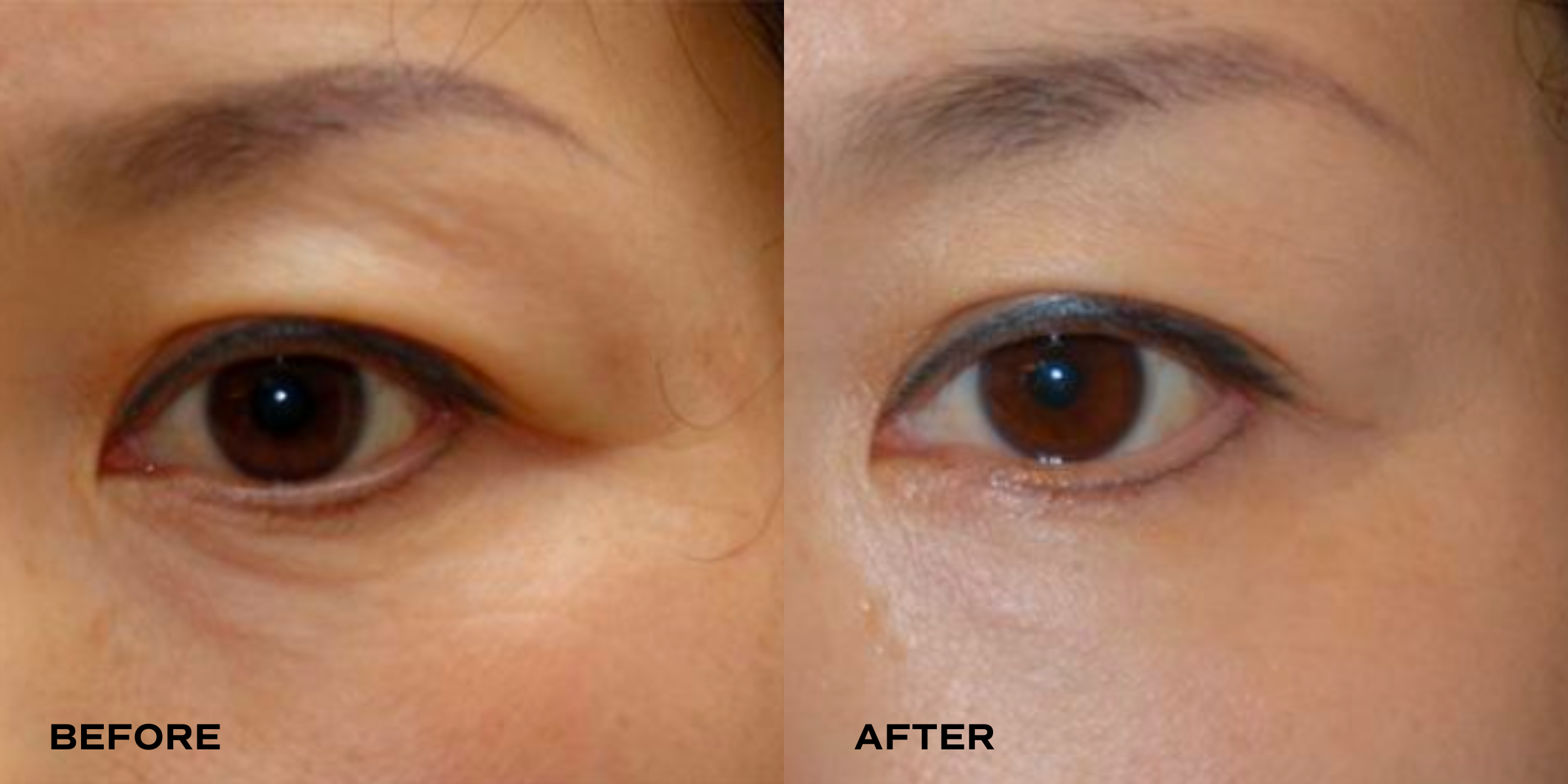 All-in-One Eye Cream Sample (6g)