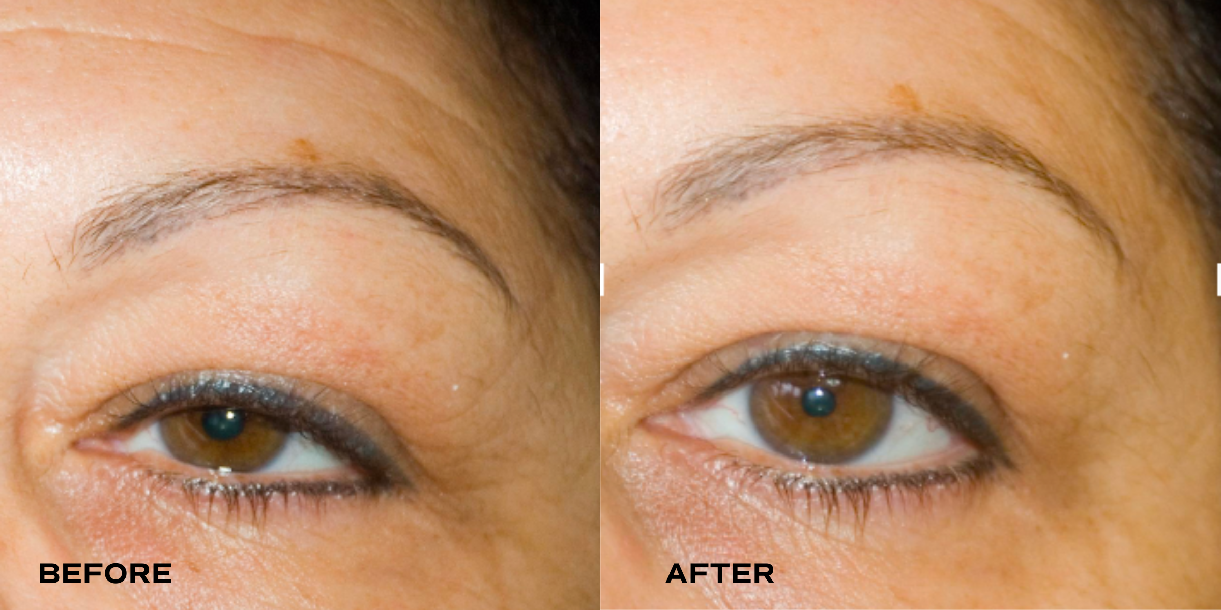 All-in-One Eye Cream Sample (5g)