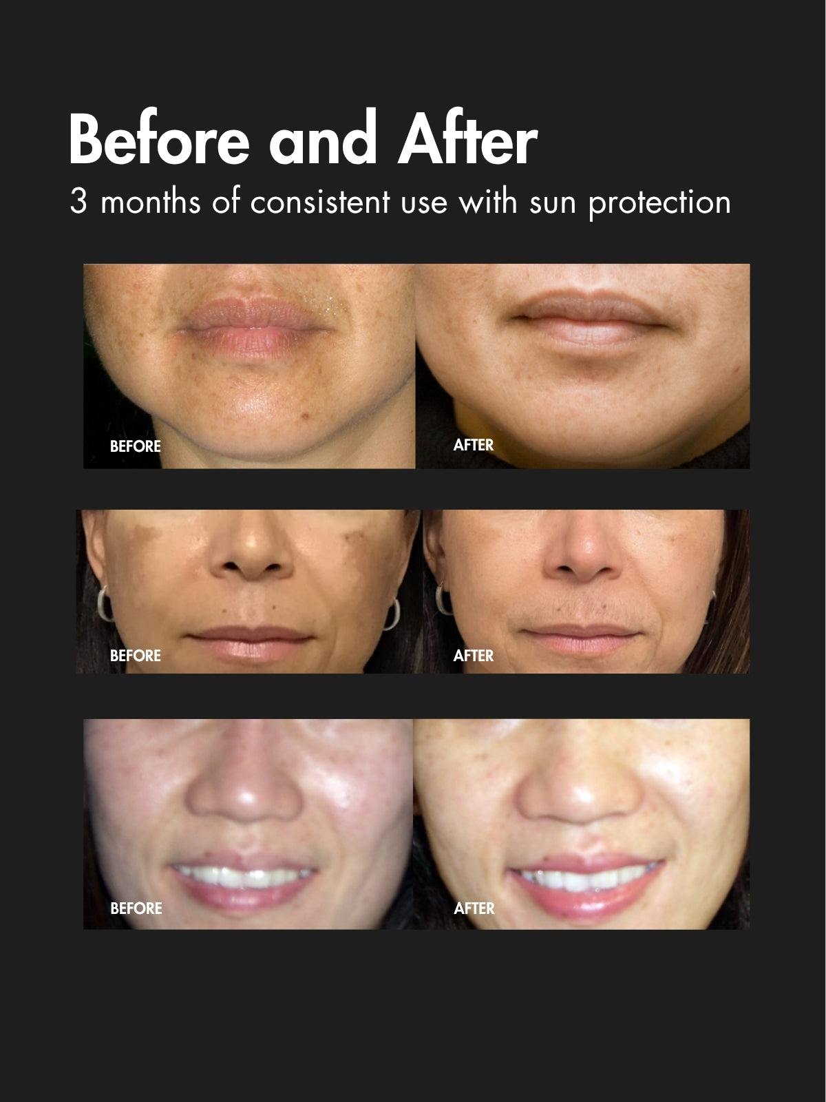 *BESTSELLER* Vitamin C Serum
